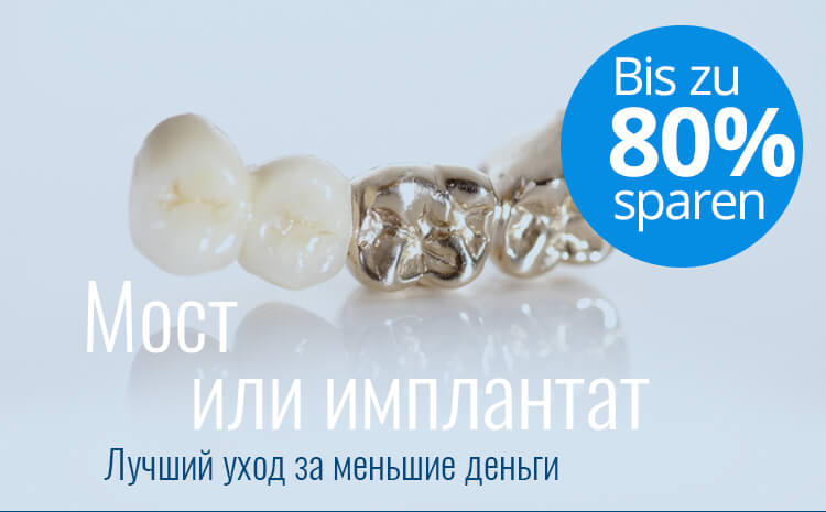 Мост или имплантат, сэкономить до 80%!