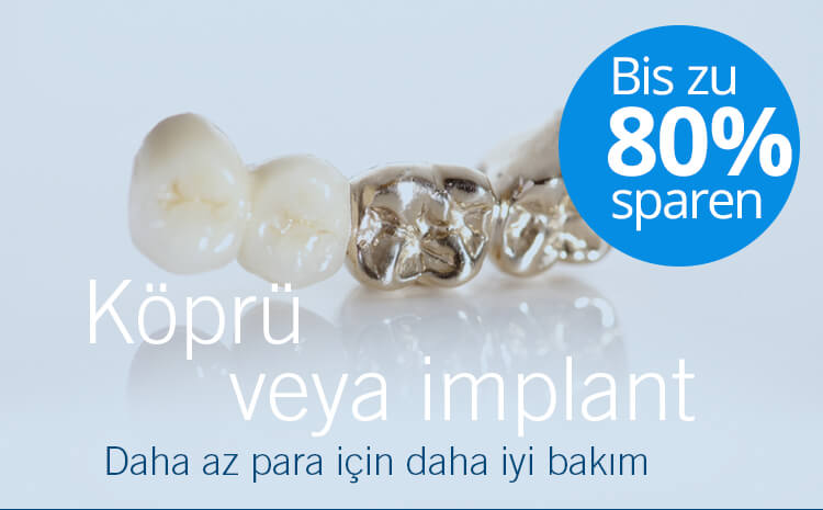 Köprü veya implant,% 80'e varan tasarruf!