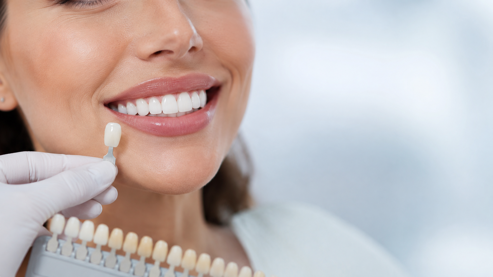 Veneers Farbauswahl: Zahnarzt bestimmt die passende Veneer-Farbe am Lächeln der Patientin
